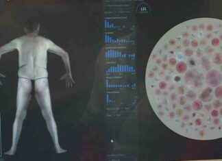 semaine-de-dpistage-des-cancers-de-la-peau-quand-lintelligence-artificielle-sauve-des-vies